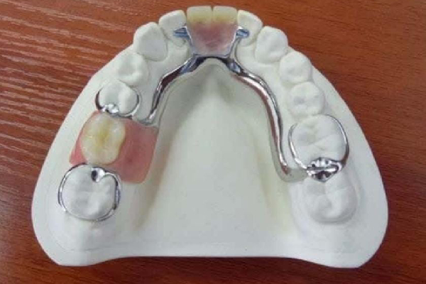 Dentures