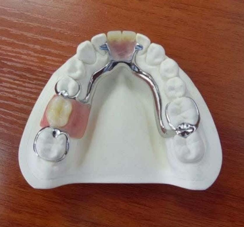 Removable Teeth - Dentures