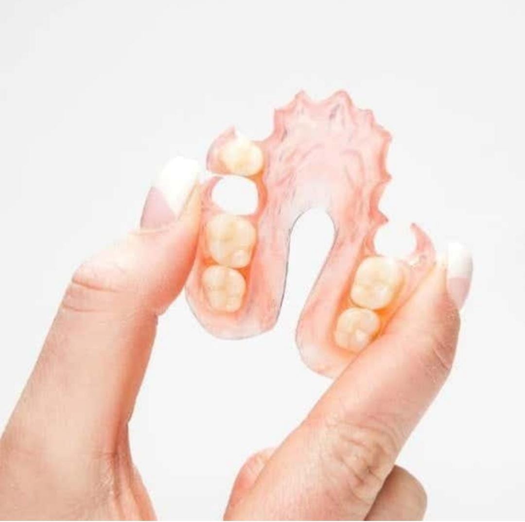 Complete Dentures