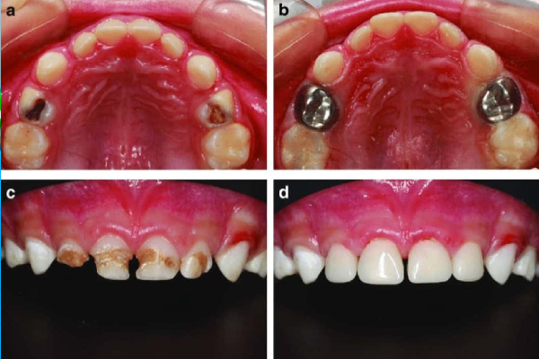 pediatric dentistry
