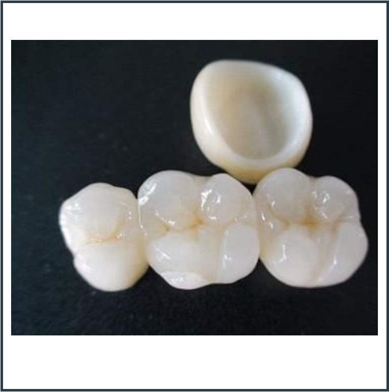 Fixed Teeth